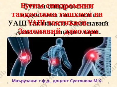 буғимсиндроми ташхиси ва даволаш принциплари — PPTX