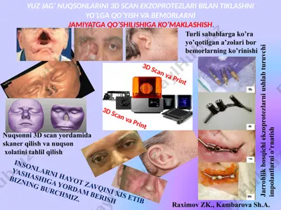 yuz jag’ nuqsonlarini 3d scan ekzoprotezlari — PPTX