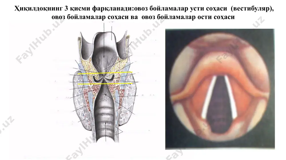 ўсмани баҳолаб бўлмайди; т0-бирламчи ўсма тўғрисида маълумот йўқ. тin situ - эпителий ичи (преинвазив ) рак (carcinoma in situ). 1. овоз бурмалари усти -вестибуляр (ҳиқилдоқ даҳлизи) соҳаси (с 32.1). т1 — ўсма вестибуляр соҳанинг бир қисми билан чегараланган ва овоз боғламалари ҳаракати нормада. т2 – ўсма вестибуляр соҳа шиллиқ қаватининг бир нечта қисмини ёки овоз бурмалари соҳасини ёки ҳиқилдоқ вестибуляр қисми чегарасидан ташқи (тил илдизи, еpiglottis чуқурчалари,ноксимон чўнтак - recessus piriformisнинг медиал девори) соҳа шиллиқ қаватини зарарлайди,аммо ҳиқилдоқ фиксацияланмайди. тз-ўсма ҳиқилдоқ чегарасидан чиқмайди,лекин овоз бурмаларини фиксация қилади ва/ёки овоз бурмалари олди бўшлиғига ва/ёки қалқонсимон тоғайнинг ички пўст қаватига ўсиб ўтади.­ т4а— ўсма қалқонсимон тоғайнинг бутун қалинлигига ўсиб ўтади ва/ ёки ҳиқилдоқдан ташқари тўқималарни (масалан: трахея, бўйин юмшоқ тўқимаси, тилнинг хусусий мушаклари — т. gertioglossus, т. hyoglossus, т. palatoglossus, т. styloglossus; бўйиннинг ҳиқилдоқ олди мушаклари,қалқонсимон без ёки қизилўнгач) зарарлайди. т4b— ўсма умуртқа поғонаси олди фасцияси,кўкс оралиғи ўсиб ўтади ёки уйқу артериясини …