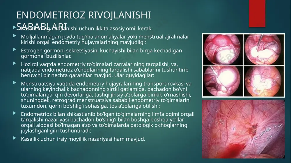 aytida ko’p qon yo’qotish, anemiyaga olib keladigan bachadondan qon ketishi, sezilarli og’riq sindromi qayd qilinadi. ko’pincha adenomioz ayollarning bepushtligi sababchisi bo’lib, homiladorlik boshlanishiga va / yoki homila ko’tarishga to’sqinlik qiladi. bachadon bo’yni endometriozi bachadon bo’ynida endometriy hujayralarining o’sib ketishi hollarining ko’payganligini mutaxassislar eroziyani davolash uchun jarrohlik aralashuvlar o’tkazish bilan bog’lamoqda. bachadon bo’ynida kuydirish yoki boshqa manipulyatsiyalar hayzdan oldingi davrda amalga oshirilgan bo’lsa, endometriy hujarlararining menstrual ajralmalar bilan transportirovkasi vaqtida birikib o’sib ketishi ehtimoli mavjud. tuxumdon endometriozi tuxumdon to’qimalarining endometrioid kistalar bilan shikastlanishi — endometriozning eng keng tarqalgan shakllaridan biridir. tuxumdonlarning endometriozida organizmning reproduktiv funktsiyasi buziladi: tuxumdondagi kistalar ovulyatsiya jarayoniga to’sqinlik qiladi. tuxumdonlarning shikastlanishi follikullar zahirasining kamayishi, ayollarning bepushtligi bilan xavfli hisoblanadi. asosiy alomat — qorinning pastki qismida o’tkir og’riqlar sezilishi, ayniqsa jinsiy aloqa paytida yoki undan keyin. tuxumdonlarning endometriozi utt yordami bilan aniqlanadi. menstrual sikl davomida tekshiruv bir necha bor amalga oshiriladi, bu endometrioid va funktsional kistalarni farqlash uchun kerak. …