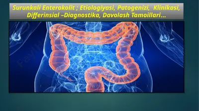 surunkali enterokolit — PPTX