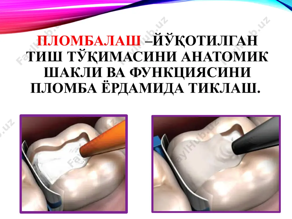 аиономер полимер пломба ашёлари тўлдиргичсиз тўлдиргичли акрил смола асосли эпоксид смола асосли композит компомер ормокер металл пломба ашёлари амальгама рух-фосфат цементлар кукун: zno (75 – 90%); mgo (5 – 13%); al2o3 (0,03 – 1%); суюқлик: h3po4 - нейтралланган ортофосфор кислотасининг сувли эритмаси. таркиби: кукун: zno – кариес кавак деворларига пломбани ёпишишини (адгезияси) ва пластиклигини таъминлайди. sio2 – пломба ашёсига шаффофлик, шишасимонлик ва ялтироқлик беради. mgo – пластиклигини ва механик мустахкамлигини оширади. cao – цементни бирикиш вақтига таъсир этади, қовушқоқлигини оширади. суюқлик: сиропсимон, шаффоф, чўкмасиз, хидсиз. рух-фосфат цемент вакиллари: фосфат-цемент унифас висфат унифас – 2 уницем адгезор (adhezor) тенет рух-фосфат цементларнинг механик хусусиятларни яхшилаш учун ва уларга бактерицид хусусият бериш учун уларга металл ва уларнинг тузлари қўшилади: кумуш тутувчи цементлар: фосфат-цемент, содержащий серебро; фосцин бактерицидный; мис ва висмут оксиди қўшилган цементлар: висфат-цемент; диоксивисфат; 32 рух-фосфат цементларнинг ижобий томони: пластиклиги; кавакка яхши ёпишиши; кам иссиқлик ўтказиши; пульпага салбий таъсири йўқлиги; рентгеноконтрастлиги. рух-фосфат …