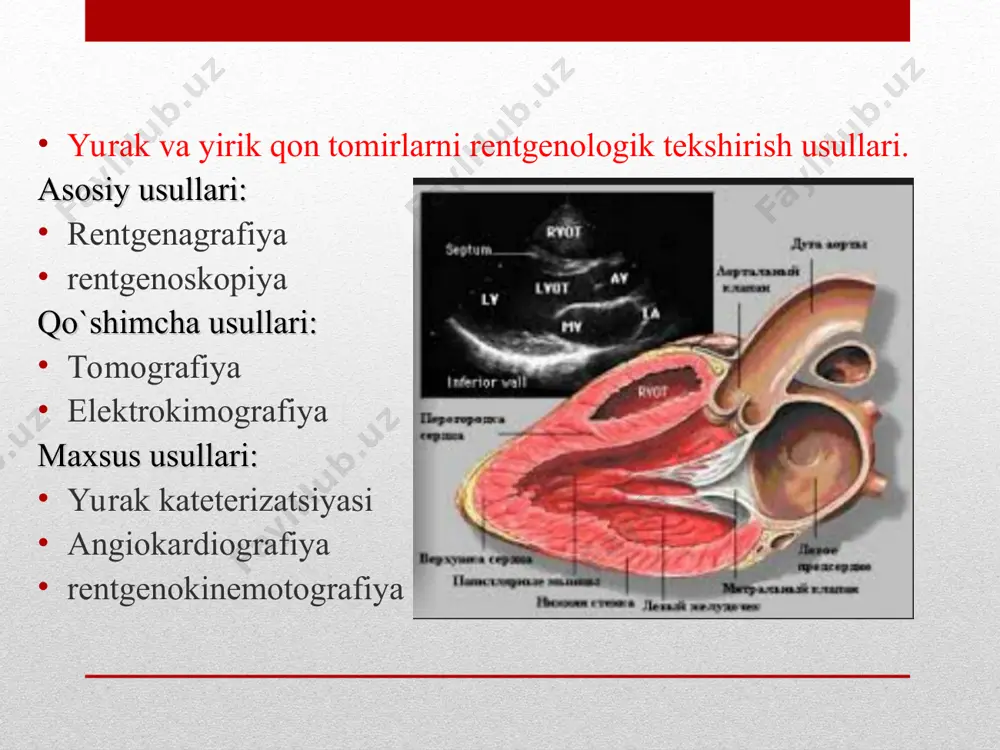 zi kombinirlangan mitral nuqsoni aortal klapn yetishmovchiligi aortal teshik stenozi 3. yallig’lanish kasalliklari. miokardit perikardit ->yopishqoq va ekssudatsiyali bo’lmachalararo nuqson (7-15% hollarda uchrydi) rentgenologik belgilari o’pka arteriyasi soyasi va o’pka ildizi soyasini kuchayishi o’pka tasvirini kuchayishi o’pka ildizi aktiv pulsatsiyaga egaligi qorinchalararo nuqson yurak mitral konfiguratsiyasi o’pka tasviri kuchaygan o’pka ildizi kuchaygan yurak beli qayd etilmaydi o’pka arteriyasi va yoyi bo’rtgan. fallo tetrada 4 ta nuqsondan iborat: -o’pka arteriyasi stenozi -qorinchalararo to’siq nuqsoni -aorta dekoarktatsiyasi -o’ng qorincha gipertrfiyasi quydagi rentgenologik belgilar kuzatiladi. -chap konturda ii yoyning botib ketishi -o’pka ildizi soyasi kichiklashuvi -o’pka tasviri noaniqligi -o’pka yorug’ligi kuchaygan -yurakning chapga kengayishi -yurak cho’qqisi kengayib yuqoriga kutarilgan -yurak etikcha shaklida mitral klapn stenozi -chap bo’lmacha kattalashuvi -o’pka arteriyasini bo’rtishi -o’ng qorincha kattalashuvi -chap qorincha kichiklashuvi -qizilo’ngach kichik radius bo’yicha orqaga surilgan aortal klapn etishmovchiligi -chap qorincha kengaygan -aortaning yuqoriga kutariluvchi qismi bir tekis kengayishi -chap qorincha qisqarishlari tezlashadi va chuqurlashadi -o’tirgan …