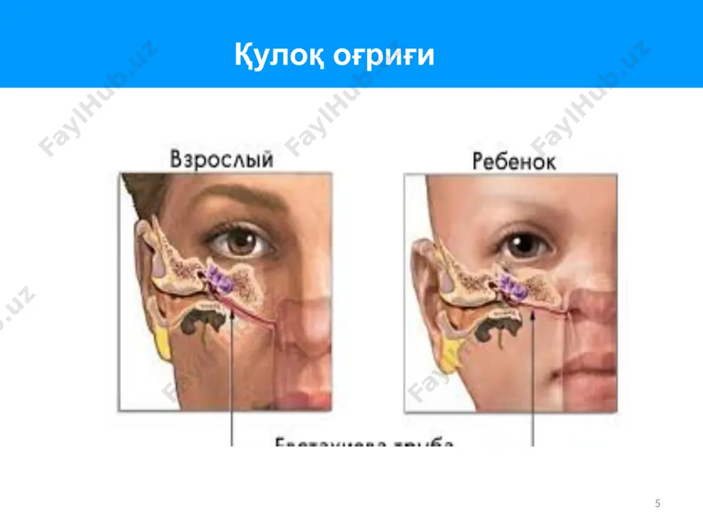 қулоқ оғриғи - Page 5