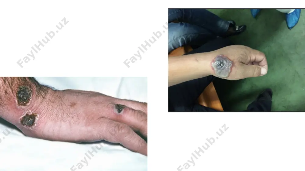bera oladi. sporotsid ta’sirga shuningdek xloraminning faollashtirilgan eritmalari, issiq formaldegid, vodorod peroksidi ham ega. eʼtiboringiz uchun rahmat