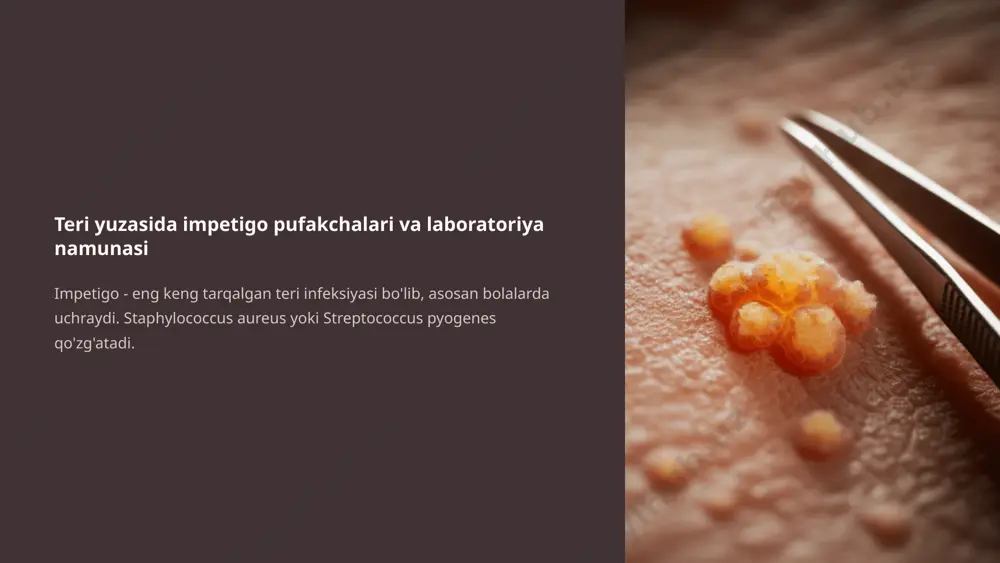 teri infeksiyalari qo‘zg‘atuvchilari, patogenez, laboratoriya tashxisi - Page 5