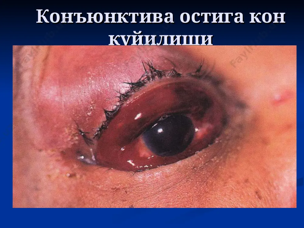 курув аъзоси травмалари - Page 3