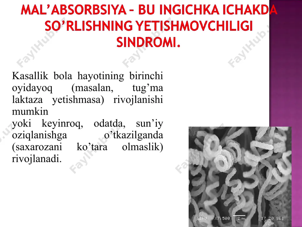i steatoreya (ko’p miqdorda yorqin axlat) axlatda neytral yog’lar ko’payishi lipolitik ferment, o’tning aktivligi pastligi, defitsitligi. tana vaznini yo’qotish, ozish, kamquvvatlik, tez charchash, qorin shishishi. axlatda yog’ va azotning ortishi glyukoza va ksiloza so’rilishining pasayishi oqsil, yog’, uglevodlar so’rilishi va gidrolizini buzilishi fe tanqisligi anemiyasi gipoxrom anemiya qon zardobida fe konsentratsiyasi pasayadi fe so’rilishi va transporti buzilishi megaloblast anemiya makrotsitoz vitamin b12 so’rilishi pasayadi qon zardobida vitamin b12 konsentratsiyasi, eritrotsitlarda folat kislota pasayadi. vitamin b12 va foli kislota so’rilishini buzilishi paresteziya, tutqanoq, truss ova xvostek simptomlari musbat. qon zardobida ca, mg va k konsentratsiyasi pasayishi neytral yog’lar va yog’ kislotalari bilan erimaydigan va so’rilmaydigan birikmada ca ning o’tishi suyaklarda og’riq, patologik sinishlar, skelet deformatsiyalari. rentgenografiya va densitometriyada osteoporoz gipokalsiyemiya yog’da eruvchi vitamin d so’rilishini buzilishi qon ketishga moyillik (ekhimozlar, melena, gematuriya) protrombin vaqtining oshishi yog’da eruvchi vitamin k so’rilishini buzilishi shishlar qon zardobida al’bumin kamayadi proteolitik fermentlar aktivligi pasayadi aminokislotalar …