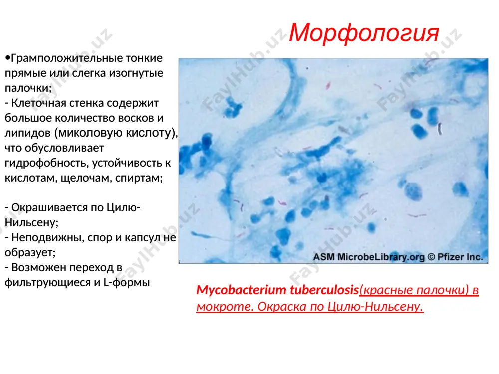 т иммуносупрессивные свойства микобактерий и модифицируют мемраны клетки хозяина; липиды обеспечивают устойчивость к комплементу, свободным радикалам фагоцитов основной фактор –туберкулин – обладает токсическими и аллергическими свойствами патогенез туберкулеза патогенез туберкулеза взаимодействие mycobacterium tuberculosis с организмом человека начинается при попадании возбудителя в легкие после адгезии с помощью корд-фактора захватываются альвеолярными макрофагами; события, которые происходят дальше (макрофаги либо сдерживают размножение микобактерий, либо нет), определяются соотношением между бактерицидной активностью макрофагов и вирулентностью микобактерий. после размножения внутри макрофага микобактерии его разрушают моноциты, выходящие из кровотока под влиянием факторов хемотаксиса, захватывают освобождаемые из разрушенных макрофагов микобактерий макрофаги переносят микобактерии в ближайшие лимфоузлы, где они долго сохраняются в виду незавершенного фагоцитоза таким образом, первоначальное попадание возбудителя в легкие или другие органы вызывает развитие малого или неспецифического воспаления с макрофагальной инфильтрацией патогенез (продолжение) через 2-4 нед после заражения начинается следующий этап взаимодействия микобактерий с макроорганизмом. при этом наблюдаются два процесса - реакция повреждения ткани по типу гзт(специфическая …