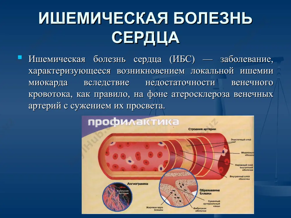 лучают соответствующее лечение; в остальных случаях болезнь не диагностирована. высокий общий риск развития фатальных сердечно-сосудистых событий имеют следующие группы пациентов. больные с установленным ссз. пациенты без симптомов болезни, у которых выявляют множественные факторы риска, и 10-летний риск развития фатального сердечно-сосудистого поражения, равный 5% и выше, значительно повышенные уровни отдельных факторов риска (концентрация общего холестерина выше 8 ммоль/л, лнп выше 6 ммоль/л, ад выше 80/110 мм рт.ст.), а также больные, страдающие сд в сочетании с микроальбуминурией. скрининговые тесты диаграммы риска - позволяют на основании подсчёта суммы факторов рисков (пол, возраст, курение, уровень систолического ад, концентрация холестерина) выделить группу больных с высоким риском. для оценки общего сердечно-сосудистого риска используют шкалу score (systematic coronary risk evaluation — системная оценка коронарного риска), в которой учтены все варианты фатальных сердечно-сосудистых событий, развитие которых возможно в течение предстоящих 10 лет жизни у лиц, не имеющих клинических проявлений ибс. диаграммы риска в системе score использованы следующие факторы …