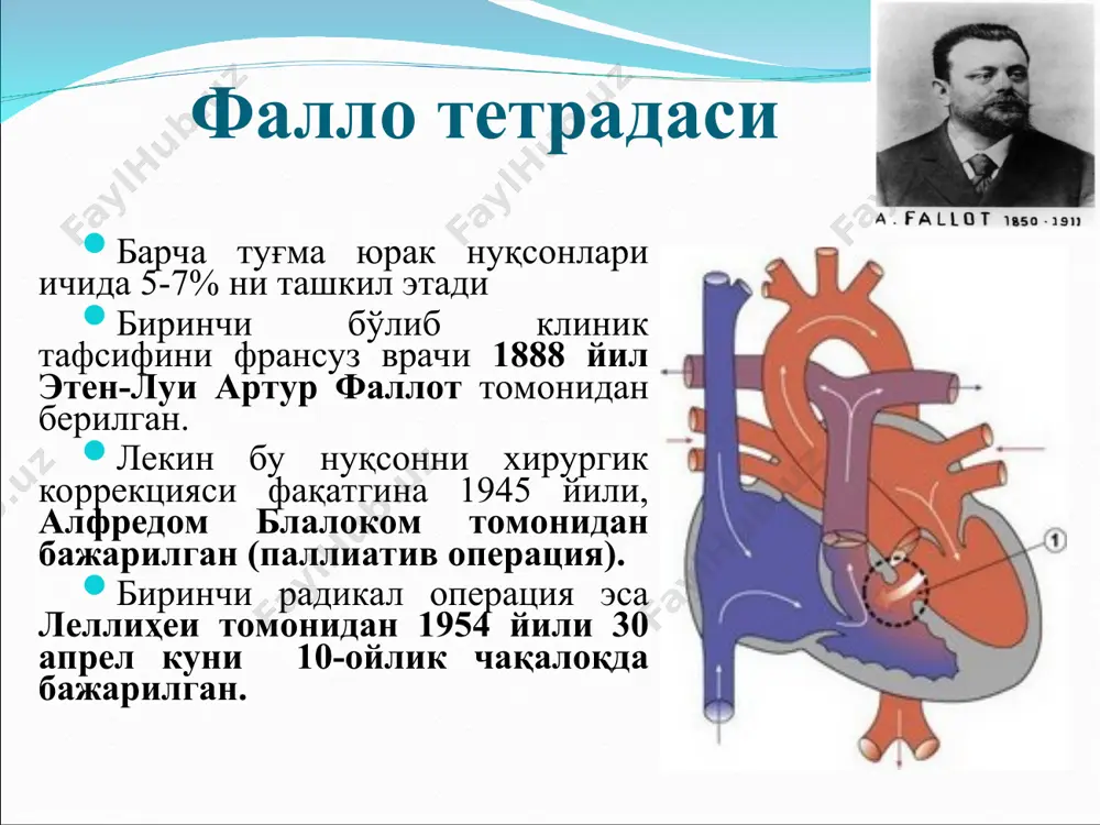 (аортал клапан ёриқларининг битиши ёки аорта огзидаги чандиқлар қисқариши) сабаблари: -ревматик эндокардит -бактериал эндокардит -атеросклероз -туғма пороклар шикоятлар: -стенокардия типида юрак сохасидаги оғриқлар. -бош айланишлар, -бош оғриқлар, -бехушликка мойиллик. кўздан кечириш: -тери рангининг окариши -юрак учи турткисини чап томонга, баъзан пастга кўчган кучли силкинишда намоен булиши пайпаслаш(пальпация) -юрак учи турткисини чап томонга, баъзан пастга кўчган кучли силкиниши. - аорта устида систолик «мушук хириллаши» юзага келади. аорта тешиги стенозида гемодинамиканинг бузилиши перкуссияда юракнинг бўғиқ овози чап қоринчанинг кенгайиши ҳисобига чап томонга силжиганлиги аниқланади. юрак бели яхши ифодаланган аортал конфигурация вужудга келади. аускультация: юрак чўққисида чап қоринчанинг хаддан ташқари тўлиб кетиши ва секин қисқариши натижасида i тон сустлашади. аорта устида: ii тон пасайган ёки эштилмайди. у ерда дағал қсистолик шовқини эштилади. баланд систолик шовқин юрак чўққисида ва бутун юрак сохасида, хатто орқада эштилиши мумкин, у аортадан эштилади. томир уриши (пульс): суст (parvus) ва сийрак (tardus). одатда систолик артериал босим пасайган, диастолик эса …