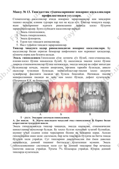 эмаль гипоплазияси — DOCX