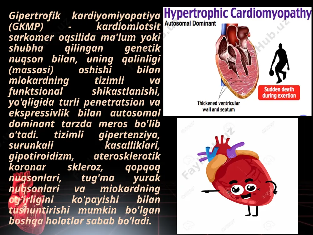 g exografik belgilari aniqlanadi. gkmp ning chastotasi turli populyatsiyalarda taxminan bir xil, ammo gkmp ning atipik variantlari osiyoda ko'proq uchraydi. bolalar orasida gkmp chastotasidagi gender farqlari, ammo kattalarda kasallik erkaklarda ko'proq aniqlanadi. farqlar gormonal omillar, tashqi muhitning ta'siri, yanada yorqin alomatlar yoki erkaklarda chq chiqishi yo'llarining obstruktsiyasining ko'proq darajasi bilan izohlanadi. bularning barchasi gkmp tashxisiga olib keladigan tez-tez tadqiqotlarni keltirib chiqaradi. patofiziologiyasi gen nuqsoni miyofibrillar faoliyatining diskoordinatsiyasiga va keyinchalik fibroz va miokard gipertrofiyasiga olib keladi. hujayra strukturasining tartibsizligi allaqachon gipertrofiya belgilari bo'lmagan va qorincha taxikardiyalari va fibrilatsiyalari uchun aritmogen substrat bo'lgan joylarda sodir bo'ladi. shu bilan birga, intramural koronar arteriyalarning intimasi qalinlashadi, qalinlashgan miokardga kislorod tashish buziladi, ishemiya, hujayralar o'limi, skleroz paydo bo'ladi. qorinchalarning devorlari qalinlashadi, lekin ichki hajmi o'zgarishsiz qoladi yoki hatto kamayadi. sistolik funktsiya uzoq vaqt davomida o'zgarmaydi, miokardning qattiqligi keskin ko'tariladi, so'nggi diastolik bosim oshadi va qonning qaytishi qiyinlashadi. gipertrofiyalangan miokard chq chiqish yo'llarini toraytirishi mumkin. obstruktsiya …