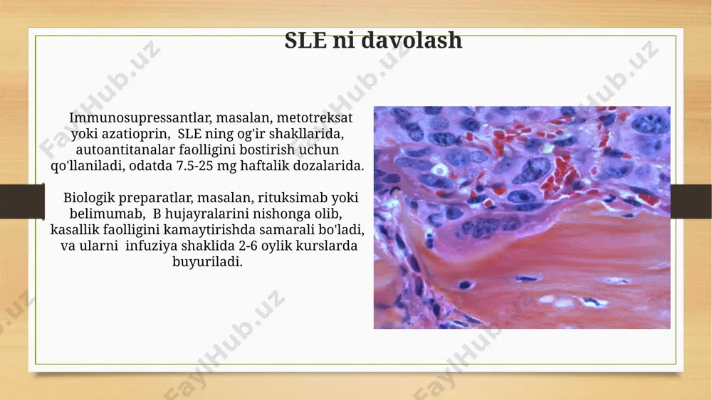 q hollarda musbat natija beradi va kasallik faolligini aniqlashda muhim ahamiyatga ega. kasallikning klinik belgilariga asoslangan amerikan revmatologiya kollegi (acr) mezonlariga ko'ra, kamida 4 ta belgining mavjudligi sle diagnostikasini qo'yishga imkon beradi, va bu mezonlar diagnostika jarayonida muhim rol o'ynaydi. raynaud sindromining sabablari kichik tomirlarning spazmi yoki torayishi raynaud sindromining asosiy mexanizmi hisoblanadi; bu jarayon periferik qon aylanishining buzilishiga va barmoqlarning oqarishiga olib keladi. taxminan 5-10% hollarda ogʻirroq asoratlar kuzatiladi. genetik moyillik ham raynaud sindromining rivojlanishiga hissa qoʻshishi mumkin; ba’zi tadqiqotlar oila a’zolarida kasallikning yuqori tarqalishini koʻrsatdi. bundan tashqari, ayrim dori vositalarining yon ta’siri ham bu sindromni keltirib chiqarishi mumkin. raynaud sindromining alomatlari ogʻir holatlarda, raynaud sindromi teri yaralari va toʻqimalarning nekroziga (oʻlimiga), hatto barmoqlarning amputasiyasi ehtimoliga olib kelishi mumkin. raynaud sindromi bilan ogʻrigan bemorlarda qoʻl va oyoq barmoqlarining terisi 1-5 minut davomida oqarib, soʻngra koʻk rangga kirishi kuzatiladi, bu esa qon aylanishining buzilishini koʻrsatadi. e'tiboringiz uchun rahmat @taqdimot_robot image7.jpg …
