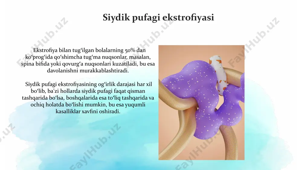 siydik ayiruv aʼzolarining rivojlanish nuqsonlari - Page 5