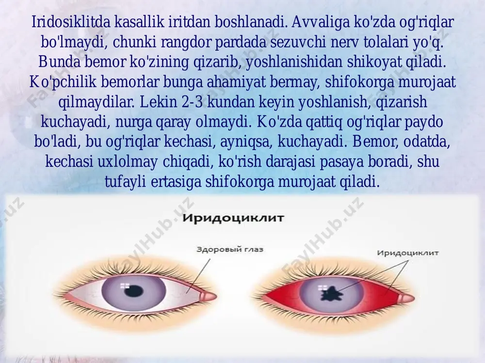parin qo'llaniladi. vitaminlardan c, b2, e, pp, gipofiz gormonlari, testikulyar va tireoid preparatlar foydalidir. metabolik steroidlardan retobolil, neyrobol yaxshi ta'sir qiladi. d vitamini pigmentli distrofiyaning avj olishiga ta'sir qilishi sababli uni bemorning ovqatlanish ratsionidan olib tashlash kerak. jarrohlik muolajalarda so‘nggi paytda tomirli pardada qon aylanishini yaxshilash maqsadida ko‘zni xarakatlantiruvchi muskullarni perixorioidal sohaga qisman ko‘chirib o‘tkazish ko‘rinishidagi to‘r pardada qon aylanishini kuchaytirish usullari sinalmoqda. bu usullar bir qator bemorlarda ijobiy natija bermoqda. to‘r pardaning yirtilib, joyidan ko‘chishi to‘r parda butun uzunligi bo‘yicha tomirli parda bilan bo‘sh tutashgan va ko‘rish nervi sohasi va arrasimon chiziq oldida mahkam birikkandir. u shishasimon tana va tomirli parda orasida joylashgan bo‘lib, ba'zan shishasimon tanadagi o‘zgarishlar ta'sirida, ba'zan tomirli pardadagi o‘zgarishlar ta'sirida ko‘pincha patologik jarayonlarga uchraydi. jarohatlar va uzoqdan ko‘rolmaslikning yuqori darajasida ham to‘r parda ko‘chishi mumkin. ko‘pincha to‘r pardaning yirtilishi ko‘z olmasining yuqori tashqi kvadrantida, ya'ni yuqori qiyshiq muskul birikkan joyda kuzatiladi. yirtilgan joydan shishasimon tanadan …