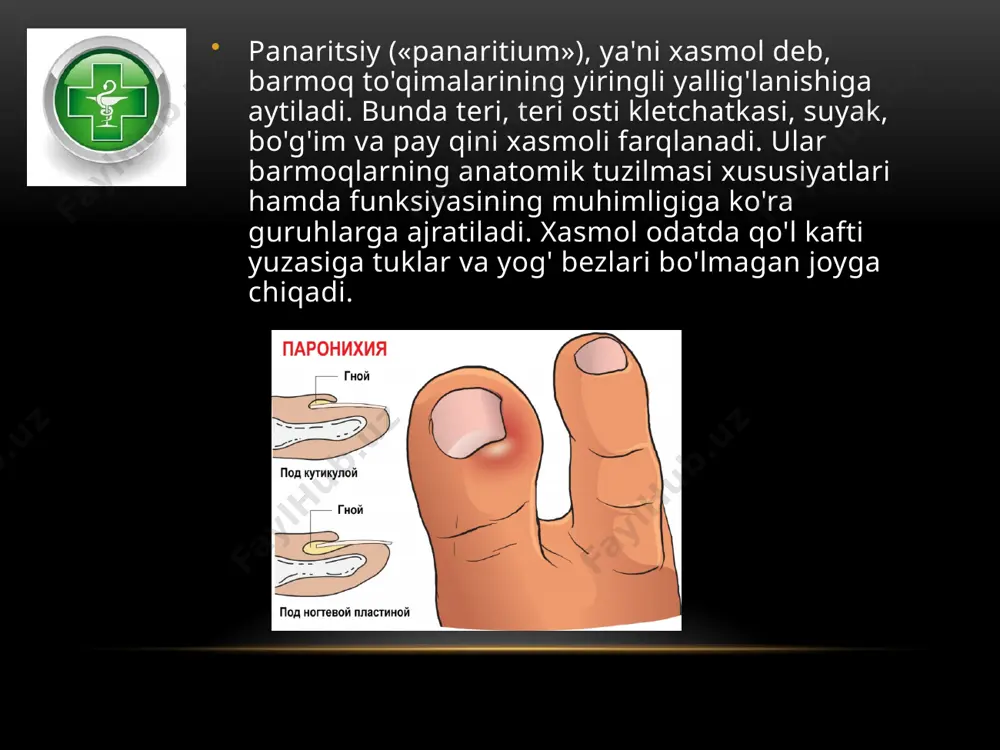 roq u falanganing kaft tomonida joylashgan bo'ladi. teri osti xasmoli nisbatan ko'proq uchrab turadi va panjaning barcha yiringli kasalliklarining 45-50 foizini tashkil etadi. patologik-anatomik manzarasi. shish bannoqning orqa yuzasida, to'qimalar zichligi kam bo'lgan joyda rivojlanadi. yog' qavatining nekrozlanishi va yiringli yemirilishi tezlik bilan boshlanadi. klinik manzarasi qon aylanishining darhol buzilishi natijasida o'qtino'qtin qattiq og'riq turadi. og'riq tufayli uyqusizlik kelib chiqadi, ishtaha bo'g'iladi. barmoq shishadi, teri kerikadi. yallig'lanish markazida og'riq birdaniga zo'rayadi. jarayon chuqurroqqa tarqalganligi sababli flyuktuatsiya bo'lmaydi, shishda teri taranglashgani kuzatiladi. intoksikatsiya belgilari bemoming o'zini yomon his qilishi, haroratning ko'tarilishi (37,5-38°c), ko'proq et uvishishi kabi jarayonlarda kuzatiladi. pay xasmoli (pay qini xasmoli, tendovaginit) pay qinining hamda pay sinovial pardasining yallig'lanishi panjaning eng og'ir yiringli kasalliklaridan biri hisoblanadi. yiringli jarayon odatda ikkilamchi hoi sifatida paydo bo'ladi. bunga teri osti, bo'g'im yoki suyak xasmollaridan, ayniqsa, o'z vaqtida jarrohlik yo'li bilan davo qilinmagan hollarda o'tgan infeksiya sabab bo'ladi. patologik-anatomik manzarasi. pay qinida va …