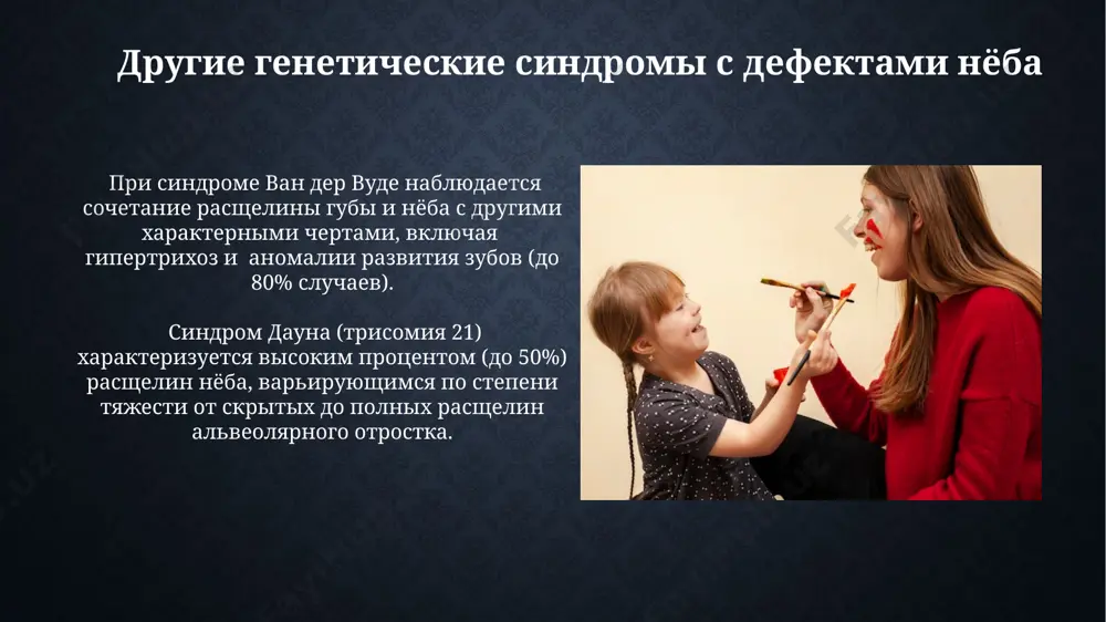 **небные расщелины: возрастные особенности и патологии** - Page 5