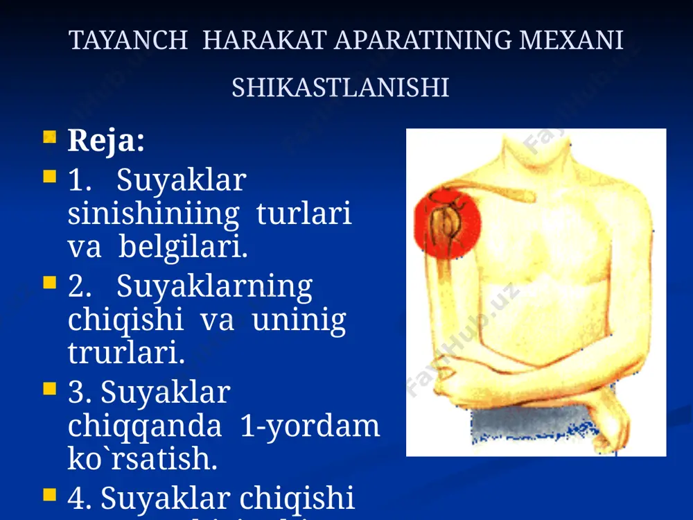 agi turlari ma`lum: 1) shikastlanish oqibatida yuz bergan travmatik chiqishi. 2) boylam apparati va suyaklarning boylam uchlari zararlanishi bilan bog`liq bulgan kasalliklarda sodir bo`ladigan patalogik chiqishi. 3) tug`ma chiqishi. 4) suyakning boylam apparatining cho`zilishi natijasida ko`pincha suyakning travmatik chiqishi noto`g`rio davolanganda yuz beradigan odat bo`lib qolgan chiqishlar. 5) o`z vaqtida joyiga solinmagan - eskirgan suyak chiqishi. suyaklar chiqanda birinchi yordam. oyoq va qo`lni immob-ya qilish zarur. og`riqni pasaytirish maqsadida suyak chiqqan zonada muz yoki sovuq suv solingan xaltachada qo`yiladi. analgetiklar yuboriladi shundan so`ng bemorni zudlik bilan davolash muassasasiga junatiladi. chiqqan suyakni vrach tug`rilaydi. suyak chiqishining turiga va qaerdagi suyak chiqqaniga qarab, uning urniga solishning muayyan usullari mavjud. bug`im bo`shlig`iga novokain yuborib, mahalliy og`riqsizlantirishdan so`ng suyak joyiga solinadi. m: yirik bo`g`imda chanoq-son bo`g`imda suyak chiqqanda skelet muskullari tonusni bushashtirish uchun miorelaksantlar bilan umumiy og`riqsizlantirishga to`g`ri keladi. chiqqan suyak joyiga solingandan so`ng oyoq yoki qo`lni bog`lam yoki gips longeta bilan 4-5 kunga …