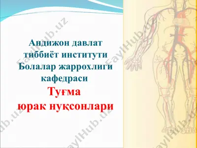 tuğma yurak nuqsonlari — PPT