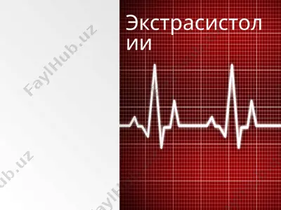экстрасистолии — PPT