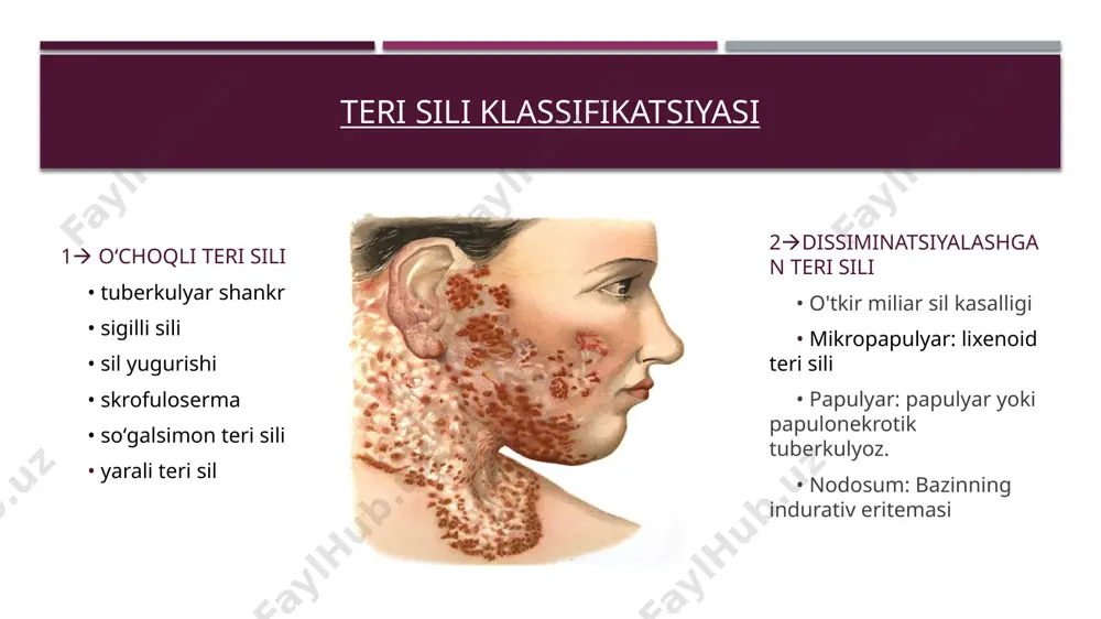 an joylardir. kasallik teri osti yog 'to'qimalarida bir yoki bir nechta zich, aniq belgilangan tugunlar, ularning ko'rinishi, 1-3 sm,, no'xat o'lchami bilan tavsiflanadi. sekin-asta kattalashib, tugunlar tovuq tuxumining o'lchamiga etib borishi va terining sirt qatlamlari bilan birlashishi mumkin, bunda esa koʻkimtir binafsha rangga kiradi. bora-bora tugun markazi yumshab terisi yupqalashadi (colliquatio – yumshoq demakdir), qizarib yallig‘lanadi, bir yoki bir nechta joydan uch berib, yoriladi, bunda teshikli yaralar paydo bo‘ladi (fistula). yaralarning qirralari notekis bo‘lib, ichidan qon aralash yiring ajralib turadi. zararlangan o‘choqlardagi yaralarning rivojlanishi turlicha, ya’ni biri endi boshlanayotgan bo‘lsa, ikkinchisi bitib, chandiqlanib turadi. teshik yaralar, aksari bo‘shliqlar orqali bir-biri bilan tutashib turadi. yara teshiklariga metall zond kiritib, o‘sha bo‘shliqlarni topish mumkin. yaralar o‘z-o‘zidan har xil shakldagi o‘siqlari bor notekis chandiqlar hosil qiladi. yarali teri tuberkulyozi (orificialis tuberculosis, tuberculosis cutis orificialis, o'tkir sil yarasi). silning bu klinik shakli balg'am, siydik va najas bilan chiqariladigan mikobakteriyalarning otoinokulyatsiyasi natijasida tabiiy teshiklar (og'iz, …