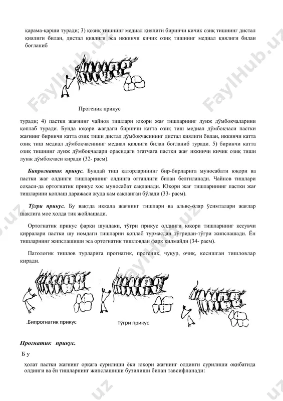 юқори жағ кесувчилари пастки жағ кесувчиларининг тил дўмбоқчасига етмай тил юзасига тегиб туради; 2) юқори жағ қозиқ тиши пастки жағдаги биринчи ва иккинчи озиқ тишлар билан қарама-қарши туради; 3) қозиқ тишнинг медиал қиялиги биринчи кичик озиқ тишнинг дистал қиялиги билан, дистал қиялиги эса иккинчи кичик озиқ тишнинг медиал қиялиги билан боғланиб прогеник прикус туради; 4) пастки жағнинг чайнов тишлари юқори жағ тишларнинг лунж дўмбоқчаларини қоплаб туради. бунда юқори жағдаги биринчи катта озиқ тиш медиал дўмбоқчаси пастки жағнинг биринчи катта озиқ тиши дистал дўмбоқчасининг дистал қиялиги билан, иккинчи катта озиқ тиш медиал дўмбоқчасининг медиал қиялиги билан боғланиб туради. 5) биринчи катта озиқ тишнинг лунж дўмбоқчалари орасидаги эгатчага пастки жағ иккинчи кичик озиқ тиши лунж дўмбоқчаси киради (32- расм). бипрогнатик прикус. бундай тиш қаторларининг бир-бирларига муносабати юқори ва пастки жағ олдинги тишларининг олдинга оғганлиги билан белгиланади. чайнов тишлари соҳаси-да ортогнатик прикус хос муносабат сақланади. юқори жағ тишларининг пастки жағ тишларини қоплаш даражаси …