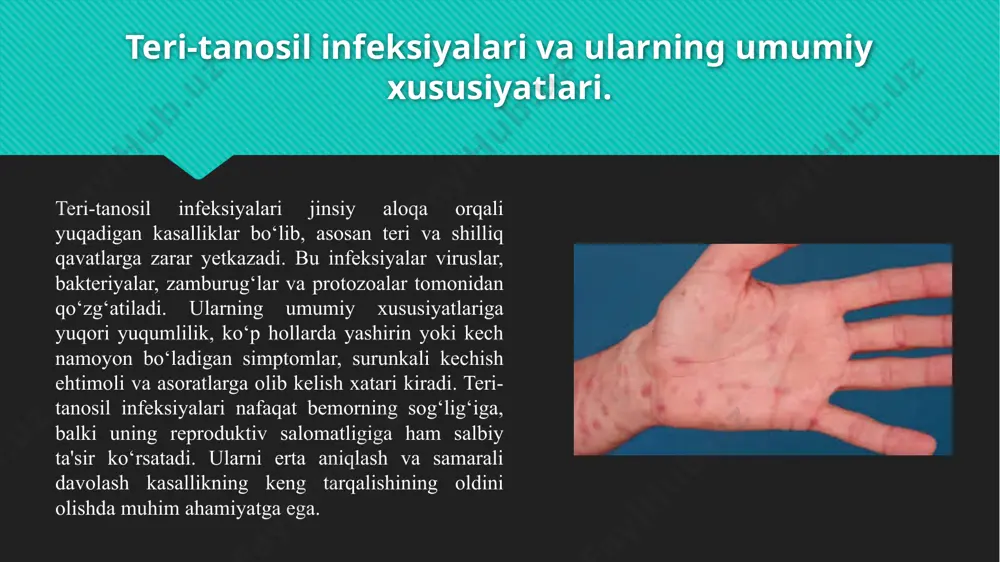 adi. zaxmni treponema pallidum ismli bakteriya qo‘zg‘atadi. bu kasallik jinsiy yo‘l bilan yuqadi va ona bolasiga ham yuqishi mumkin. zaxmning birinchi belgilari genital hududda og‘riqsiz yara (shankr) paydo bo‘lishi bilan boshlanadi. agar davolanmasa, kasallik yurak, asab tizimi va boshqa organlarga zarar yetkazishi mumkin. zaxmni davolashda odatda penitsillin kabi antibiotiklar qo‘llanadi. so‘zakni esa neisseria gonorrhoeae bakteriyasi qo‘zg‘atadi. u jinsiy yo‘l bilan yuqadi va ona bolaning tug‘ilishi vaqtida ham yuqishi mumkin. so‘zakning asosiy belgilari og‘riq, noqulaylik va genital hududdan oqishdir. davolash uchun antibiotiklar kerak bo‘ladi. teri-tanosil infeksiyalarining klinik belgilari va kechishi. zaxm kasalligi treponema pallidum bakteriyasi tomonidan qo‘zg‘atiladi, u organizmga shilliq qavatlar orqali kiradi va butun tana bo‘ylab tarqaladi. so‘zak kasalligi esa neisseria gonorrhoeae bakteriyasi bilan yuzaga keladi, bu bakteriya jinsiy a'zolar, siydik chiqarish yo‘llari va ko‘z shilliq qavatini zararlaydi. xlamidioz infeksiyasining qo‘zg‘atuvchisi chlamydia trachomatis bo‘lib, u ko‘pincha yashirin tarzda rivojlanadi va reproduktiv tizimga zarar yetkazadi. mikoplazmoz mycoplasma hominis va mycoplasma genitalium …