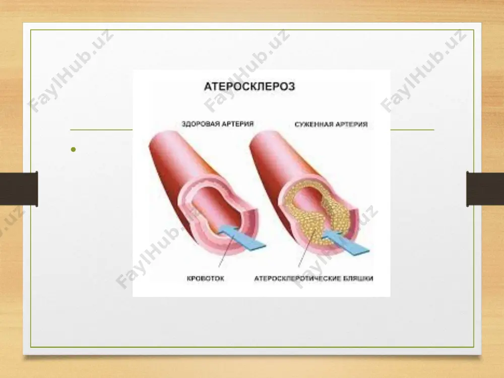 abablaridan biridir. aterosklerozga sabab bo’luvchi omillar ko’p qirralidir. shuning uchun gormonal fon darajasi, irsiy dislipoproteinemiya (plazma lipid profilining buzilishi), immun tizimining faoliyati aterosklerozning rivojlanishini tezlashtirish yoki sekinlashtirishda muhim rol o’ynaydi; aterosklerozning turlari yurak tomirlari (koronar arteriyalar) aterosklerozi. yurak ishemik kasalligi, stenokardiya va infarkt rivojlanishiga turtki beradi; aortal shakli. aorta organizmdagi eng katta arteriyadir. uning ateroskleroz bilan shikastlanishi barcha organlarga va tizimlarga sezilarli ta’sir qiladi; buyrak tomirlarining aterosklerozi. qon aylanishining yetishmasligi buyraklar vazifalarining buzilishi va og’ir arterial gipertenziyani keltirib chiqaradi; miyani qon bilan ta’minlovchi tomirlarning aterosklerozi; oyoq va qo’llar tomirlarining aterosklerozi. kasallik shakllari mustaqil namoyon bo’lishi mumkin, ammo ko’pincha tizimli ravishda yuzaga kerladi. ateroskleroz va qandli diabet kasalligi xolesterin me’da osti bezi hazm qildiruvchi shirasi va gormonlari sintezida faol ishtirok etadi va u qandli diabet rivojlanishining sababchisi bo’lmasa ham, uning kechishiga sezilarli darajada ta’sir o’tkazadi. qandli diabet qon tomirlarining aterosklerozi xavfini oshiradi (rivojlanish ehtimoli yarim baravar ortadi). bundan tashqari tomirlarning aterosklerozi …