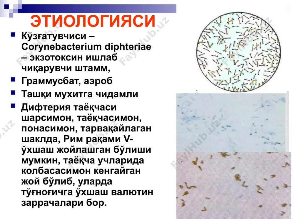 и, интоксикацион белгилар кузатилмайди. бошланишда бурунни бир томони шиллиқ қаватида жароҳатланиш бўлиб, сероз йирингли ёки қонли йирингли модда ажраши кузатилади. тез орада буруннинг иккинчи томони ҳам яллиғланиши мумкин. бурун четларида қатқалоқ пайдо бўлади. бурун дифтериясини тарқалган шаклида патологик жараён бурун бўшлиқларига ёйлади. бурун дифтериясининг токсик шаклида лунж ва бўйинда шиш пайдо бўлади. ўзгаришлар характерига қараб 2 хил шаклига фарқланади: катарал-ярали шакли – эрозиялар, яралар, қипиқлар. пардали шакли – қалин оқиш-кулранг пардалар, шиллик қават билан бирлашган ҳолда. бурун дифтерияси бурун дифтерияси томоқ дифтерияси 90-95% холларда кузатилади. қуйидаги клиник шакллари кузатилади ўчоқли формаси: дифтерия пленкаси фақат бодом бези устида бўлади ўчоқли шакли: плёнкали, оролчасимон, катарал турлари фарқланади тарқалган формаси: бунда дифтерия плёнкаси бодом безларидан ташқарига – юмшоқ танглайга, тилчага тарқалади токсик формаси: бу жуда оғир формаси ҳисобланади субтоксик токсик i, ii, iii даражада гипертоксик формада геморрагия синдроми билан кечади. томоқ дифтерияси дифтериянинг локал шакли оролчасимон шакли – оролчали, фибринозли, қаттиқ ёпишган плёнкалар …