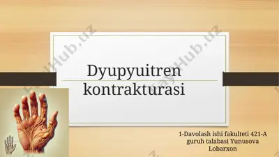 dyupyuitrenkontrakturasi — PPTX