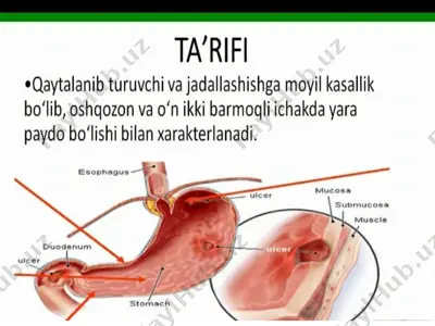 yara kasalligi — PPTX