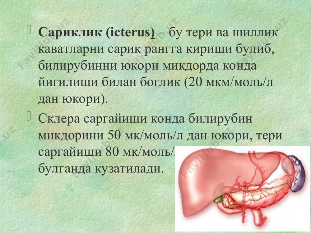 ing zararlanishi kuyidagilar sababli buladi: infektsion agent yoki ularning toksinlari (leptospiroz, sepsis), xamda gepatotsitlar uchun toksik bulgan dori preparatlarini (xinin, sulfanilamidlar) kullash. jigar usti sarikligi asosiy belgisi – giperbilirubinemiya erkin (boglanmagan) fraktsiya xisobiga axlat axoliyasi bulmaydi, axlat va peshobning tuk rangda bulishi kuzatiladi anemiya fonida teri va sklera sarikligining kuchsiz rivojlanishi jigar va talok kattalashishi mumkin, lekin jigar funktsiyalari buzilmaydi jigar usti sarikligi gemolitik kriz yukori darajasida turli ogirlik darajasida gemolitik kamkonlik oshadi – xar doim normoxrom, echt yukori rakamlarda. retikulotsitlar mikdori - 40-50% gacha oshishi xos. bu suyak kumigini kompensator reaktsiyasi bilan boglik. konning biokimyoviy tekshirishuvi – konda zardobida keskin boglanmagan bilirubin mikdorini oshishi. simptom triadasi klassik xisoblanadi – anemiya oshishi, talok kattalashishi, eritrotsitlarning sferasimonligi. bezgak utkir parazitar infektsion transmissiv kasallik bulib, plazmodiyalar tomonidan chakiriladi, isitma paroksizmalari, sariklik, gepatosplenomegaliya, anemiya bilan xarakterlanadi. kasallik patogenezida eritrotsitlar gemolizi muxim axamiyatga ega, bezgak parazitlari ta'siri natijasida eritrotsitlarning ulimi kelib chikadi. bezgak tashxis …