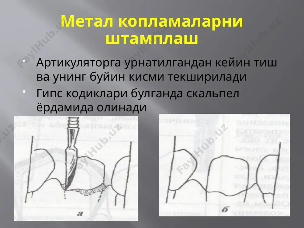узунлигида (кизил медь) пластинка кесилади пластинка олов остида халка шаклига келтирилади ва припой ёрдамида ёпиштирилади стандар кольцемер гербстани ишлатиш мумкин халка спиртда окартирилади ва клиникага юборилади халка кирасини милкга 0.5мм киритилади ва устидан термопластик масса ёки мум тулдирилиб беморга тишлаш буюрилади (антоганист тишлар нусхаси учун) 41 image2.jpeg image3.jpeg image4.jpeg image5.jpeg image6.jpeg image7.jpeg image8.jpeg image9.jpeg image10.jpeg image11.jpeg image12.jpeg image13.jpeg image14.jpeg image15.jpeg image16.jpeg image17.jpeg image18.jpeg image19.jpeg image20.jpeg image21.jpeg image22.jpeg image23.jpeg image24.jpeg image25.jpeg image26.jpeg image27.jpeg image28.jpeg image29.jpeg image30.jpeg image31.jpeg image32.jpeg image33.jpeg image34.jpeg image35.jpeg image36.jpeg image37.jpeg image38.jpeg image39.jpeg image40.jpeg image41.jpeg image42.jpeg image43.jpeg image44.jpeg image45.jpeg image46.jpeg image47.jpeg image48.jpeg image49.jpeg /docprops/thumbnail.jpeg
