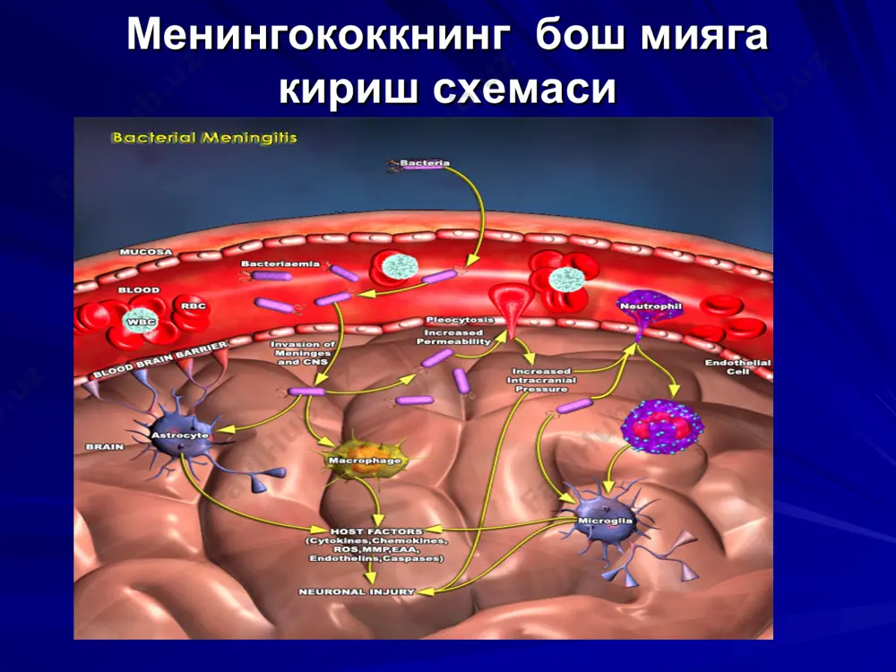 ngit va meningokoktsemiya meningit meningoentsefalit meningokoktsemiya klinikasi gemorragik toshma va xarakterli meningeal xolat (poza) meningokokkemiyaning klinik namoyon bulishi meningokokkemiya va meningitning ogirlik mezonlari toksikoz simptomlarining namoyon bulish darajasi xushning uzgarishi tana xaroratining kutarilish darajasi gemorragik-nekrotik toshmaning mikdori va ulchamlari meningeal belgilar meningokokkemiyaning yashinsimon shakli - (uta utkir) meningokokkli sepsis tana xaroraning birdan kutarilishi,kaltirash, kuzlarda kuplab gemorragik toshmalar, tarkalgan kontalashlar paydo bulishi bilan tez boshlanadi akb tushib ketadi, kon aylanishning buzilishi, dvs, talvasalar, mushaklar gipotoniyasi rivojlanadi - infektsion-toksik shok – buyrak usti beziga kon kuyilishi (uoterxauz-fridreksen sindromi) uz vaktida va adekvat davo kilinmasa 12-24 soatdan sung letal natija ruy beradi. likvor tinik, biroz limfotsitar tsitoz orka miya suyukligini tekshirish tsentrifugalangandan sung likvor bir me'yorda kon bilan buyalgan - ksantoxromiyali seroz meningit subaraxnoidal kon kuyulish gripp, urvi kizamik, parotit, sil, leptospiroz,toshmali tif, korin tifidan sung yuk birlamchi seroz meningit xa ikkilamchi seroz meningit, tasdiklangan: virusologik tekshiruv virus antigenlari bilan rtga meningokokkemiyaning klinik …