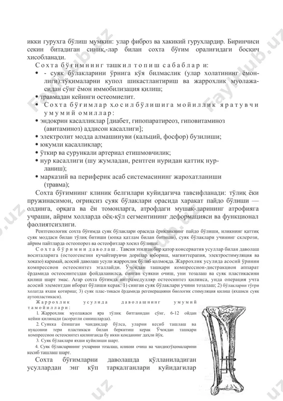 straktsion apparat yordamida osteosintezdan foydalanilsa, singan suyakni ochish, uni tozalash va suyak plastikasini qilish shart emas. agar soxta bo'g'imda intramedullyar osteosintez qilinsa, unda operatsiya uchta asosiy elementdan iborat bo'lishi kerak: 1) singan suyak bo'laklari uchini tozalash; 2) bo'laklarni to'g'ri xolatda yaxshi qotirish; 3) suyak plas-tikasi yordamida regeneratsiyani biologik stimulyatsiya qilish (yaxshisi suyak autoplastikasi). jarroxlik usulida davolashning umumiy tamoyillari: 1. jarroxlik muolajasi yara to'liq bitganidan so'ng, 6-12 oydan keyin qilinadi (asoratli sinishlarda). 2. suyakka yopishgan chandikdar bo'lsa, ularni kesib tashlash va nuqsonni teri plastikasi bilan berkitish kerak o'chokdan tashqari kompression osteosintez qilinganda bu ikki qoidaning dahli yo'q. 3. suyak bo'laklari yaxshi quyilishi shart. 4. suyak bo'laklarining uchlarini tozalash, ilikni ochish va chandiqto'qimalarini kesib tashlash shart. soxta bo'g'imlarni davolashda qo'llaniladigan usullardan eng ko'p tarqalganlari kuyidagilar xyasoblanadi. "rus qulfi" tipidagi jarrohlik muolajasi. fibroz to'qima kesib olinadi. distal va proksimal suyak uchlari arralanib, 3 sm o'lchamda «zinapoyasimon» shakl beriladi, ilik ochi-ladi. "zinapoya"lar bir-biriga markam …