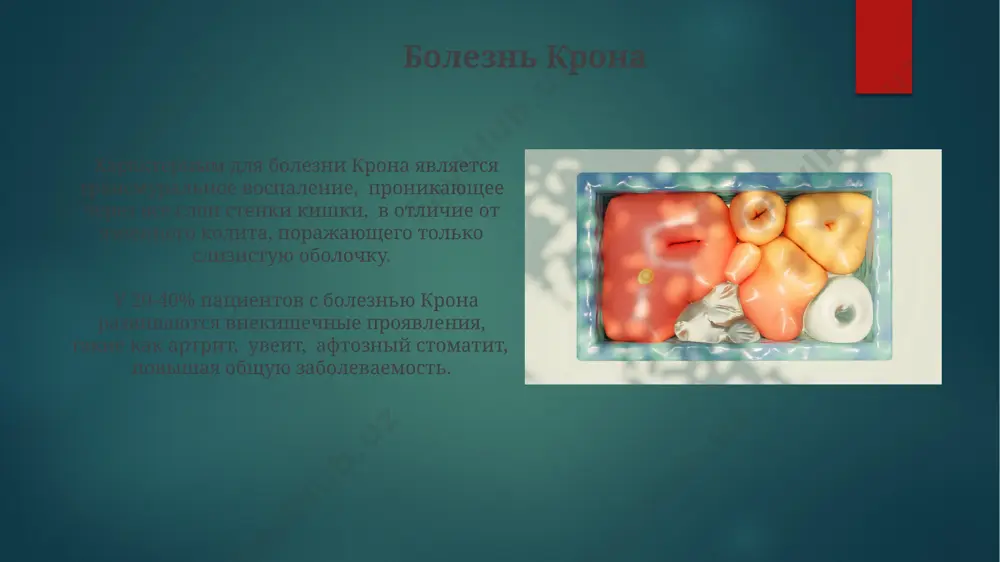 zabolevaniya organov pishevaritelnoy sistemi - Page 4