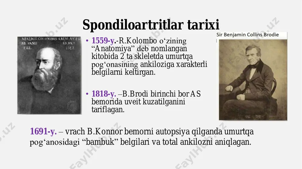 tlar – bu asosan oʻq skeletini – sakroilial boʻgʻimlar va/yoki umurtqa pogʻonasini zararlovchi surunkali immun yalligʻlanishli artritlardir. ankilozlovchi spondilit – bu spondiloartritlar guruhiga kiruvchi surunkali kasallik boʻlib, sakroilial boʻgʻimlar va/yoki umurtqa pogʻonasining zararlanishi bilan xarakterlanadi. bu jarayon ularning ankilozga olib kelishi mumkin. shuningdek, patologik jarayonga entezislar va periferik boʻgʻimlar tez-tez jalb etiladi. norentgengrafik aksspa - rentgenologik oʻzgarishlarsiz . ankilozlovchi spondilit (bekhterev kasalligi) •umurtqa pog‘onasining qattiqlashishiga (ankiloziga) olib keluvchi surunkali yallig‘lanish kasalligi. •asosan yosh erkaklarda uchraydi. •dastlabki belgilar – bel va dumg‘aza sohasidagi og‘riq, ertalabki qattiqlik va harakatning cheklanishi. dunyo bo‘ylab tarqalishi aholining 0,1-1% orasida. markaziy osiyo mamlakatlarida, jumladan, o‘zbekistonda ham taxminan 0,2-0,5% odamda as uchrashi mumkin. o‘zbekiston aholisi 36 million atrofida ekanligini hisobga olsak, as bilan kasallanganlar soni taxminan 72 000 - 180 000 kishini tashkil qilishi mumkin. etiologiya etiologiyasi aniq emas • genetik omillar hla-b27 geni mavjud bo‘lgan odamlarda kasallik rivojlanish xavfi yuqori. bu gen immun tizimining noto‘g‘ri ishlashiga …