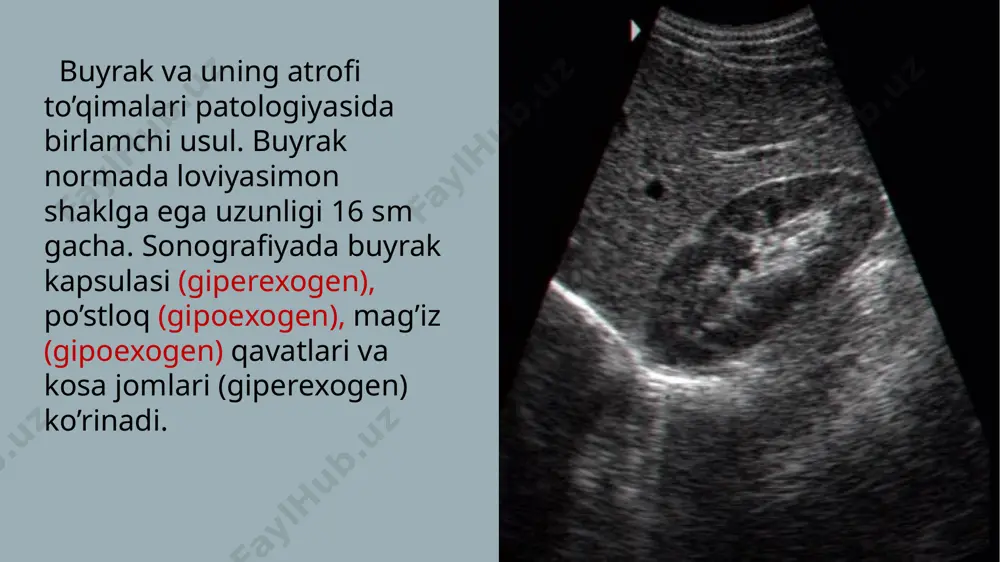 angiografiya) noinvaziv kontrastsiz mr-urografiya diffuz kasalliklar, mrt boshqa usullarga qaraganda po’stloq va mag’iz qavati farqini yaxshi ko’rsatadi, diffuz kasalliklarda bu farq yo’qolishi mumkin, lekin tashxis qimmatga tushadi. buyrak raki bosqichini aniqlashda kt nisbatan ozgina yaxshiroq. angiografiya ko’rsatmalar: buyrak arteriyalari va venalari patologiyasi – tromboz, anevrizma, stenoz, qon ketishi anomal joylashishi, av-fistula, angioma, arteriovenoz malformasiya va x.k. buyrak o’smalari va kistalari (ularning qon tomirga nisbati ko’rinadi) operatsiyadan oldin endovaskulyar muolajalar (dilatasiya, stentlash, embolizasiya, qon to’xtatish, xavfli o’smalarga lokal ximioterapiya va x.k.) nefroskleroz (qon tomirlar toraygan va deformasiyalashgan). angiografiya fazalari: 1)arterial 2)parenximatoz 3)venoz 4)pielografiya mskt angiografiya tasviri (3-d) chap buyrak arteriyasi stenozi. radionuklid stintigrafiya (renografiya). bu usul buyrak funksiyasini o’rganish uchun eng yaxshi usul hisoblanadi. venaga rfp yuboriladi va uning buyraklarda yig’ilishi grafik yoki statik shaklda ko’rsatiladi. normada renografik chiziqda 3 faza iborat: 1) qon-tomir (eng qisqa), 2) sekresiya (3-5 min) 3) ekskresiya (50% chiqib ketish vaqti 10-12 min). patologik chiziqlar: parenximatoz …