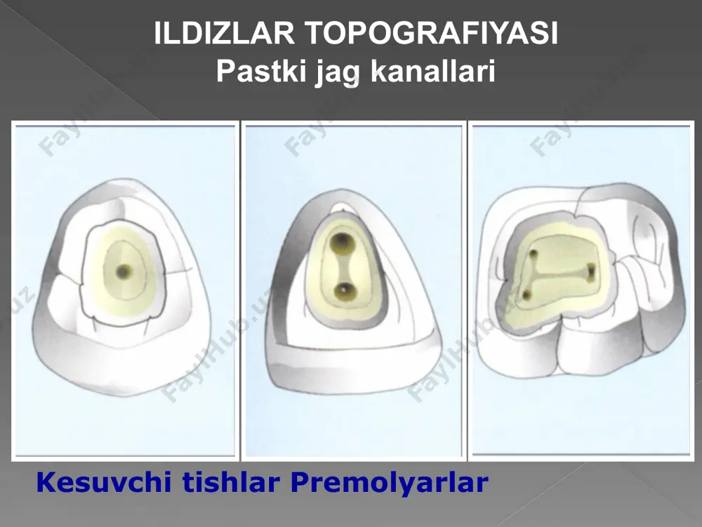 hlash qo'lda k-faylning aylanish harakatlari bilan yakunlanadi. ildiz kanallarini mehnalash sifat mezonlari (shilder, 1967) konus shaklidagi ildiz kanalining shakllanishi. ildiz kanalining barcha sirtlarini davolash. asbobning apikal teshikdan tashqariga chiqishining oldini olish. apikal teshikning etarli hajmini saqlash. image2.jpeg image3.jpeg image4.png image5.jpeg image6.jpeg image7.jpeg image8.jpeg image9.jpeg image10.jpeg image11.jpeg image12.jpeg image13.jpeg image14.jpeg image15.png oleobject1.bin image16.jpeg image17.jpeg image18.jpeg image19.png image20.png oleobject2.bin oleobject3.bin image21.png oleobject4.bin image22.png oleobject5.bin image23.jpeg image24.jpeg image25.jpeg image26.jpeg image27.jpeg image28.png image29.jpeg image30.jpeg image31.jpeg image32.jpeg image33.png oleobject6.bin image34.png oleobject7.bin image35.png image36.png oleobject8.bin oleobject9.bin image37.png oleobject10.bin image38.png image39.png