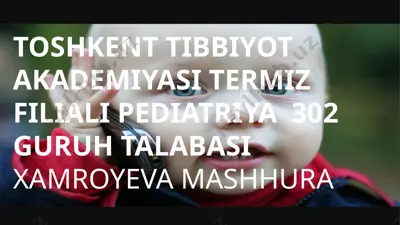akseleratsiya — PPTX