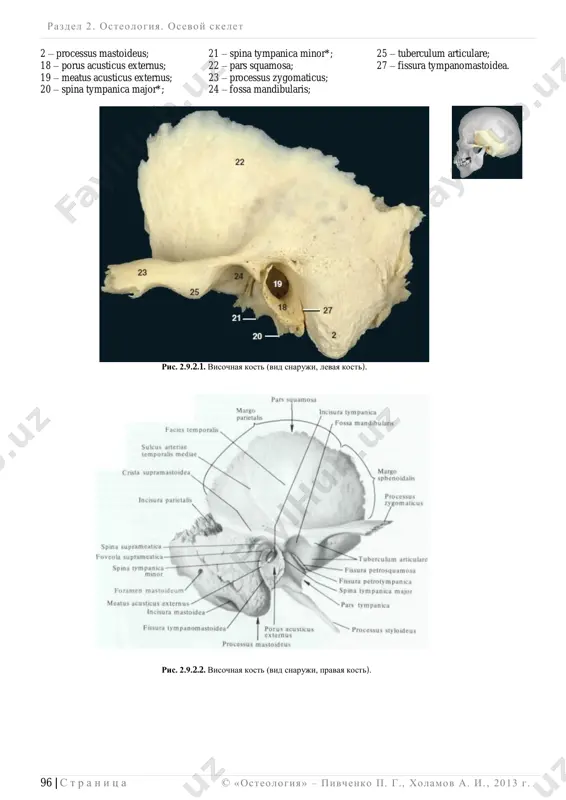 it 3 stadii osteogeneza (pereponchatuyu, xryashevuyu, kostnuyu); cheshuychataya i barabannaya  2 (pereponchatuyu i kost- nuyu). pervie tochki okosteneniya poyavlyayutsya na 2-m mesyatse embriogeneza v cheshue, na 3-m  v baraban- noy chasti, na 5-m  v piramide. sinostozirovanie (srastanie) kamenistoy, barabannoy i cheshuychatoy chastey v odnu kost otmechaetsya k 13 godam. visochnaya kost novorojdennogo i pervie godi jizni rebenka imeet sleduyushie osobennosti: bara- bannaya chast predstavlena barabannim koltsom, anulus tympanicus; nablyudayutsya: shirokiy i korot- kiy mishechno-trubnie kanali; slaborazvitiy sostsevidniy otrostok i sostsevidnie yacheyki; tonkie stenki i sheli barabannoy krishi i litsevogo kanala. starcheskie izmeneniya proyavlyayutsya osteoporozom (razrejenie kosti); usileniem pnevmatizatsii (yacheistosti) sostsevidnogo otrostka. razdel 2 . osteologiya. osevoy skelet ______________________________________________________________________________________________________________________________________________________________________________ 96 | s t r a n i ts a © «osteologiya» – pivchenko p. g., xolamov a. i. , 2013 g . 2 – processus mastoideus; 21 – spina tympanica minor*; 25 – tuberculum articulare; 18 – porus …