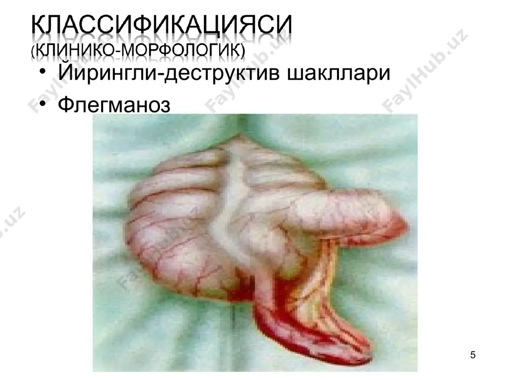 ши кузатилади. унинг сабаблари – ошкозон-ичак тракти функционал етишмовчиги натижасида бош мия жарохатланиши пневмония, упка бактериал деструкцияси уткир ичак инфекцияси сепсис корин бушлиги ва кукрак кафасидаги операциялар катта хажмли операциялардан сунг ярали-некротик энтероколит * ут аралаш куп кусиш кориннинг дам булиши газ ва ахлат чикмаслиги кучли интоксикация белгилари нафас олишни кийинлашуви ичаклар перистальтикаси товушлари эшитилмаслиги рентгенологик текширганда куп микдорда бир хил улчамли клойбер косачалри мавжудлиги * касаллик чакирувчи сабабни бартараф этиш ичаклар фалажини бартараф этиш, яъни -- ошкозон – ичак трактини бушалишига эриш тозаловчи, гипертоник, сифон клизма ошкозонни зондлаш ичаклар интубацияси ичаклар харакат фаоллигини тормозловчи ёй рефлексларини блоклаш (паранефрал блокада, метаклопропамид, церукаль, убретид, прозерин) * механик ичак тутилиши обтурацион ичак тутилиши странгуляцион ичак тутилиши инвагинацион (аралаш) ичак тутилиши * болаларда обтурацион ичак тутилишининг сабаблари копростаз аскоридоз усмалар безоар мегадолихоколон гиршпрунг касаллиги тугри ичак тугма ёки чандикли стенозлари * коринда огрик, ич утмаслиги, корин дам булиши, кусиш, интоксикация белгилари, анамнезида ич …