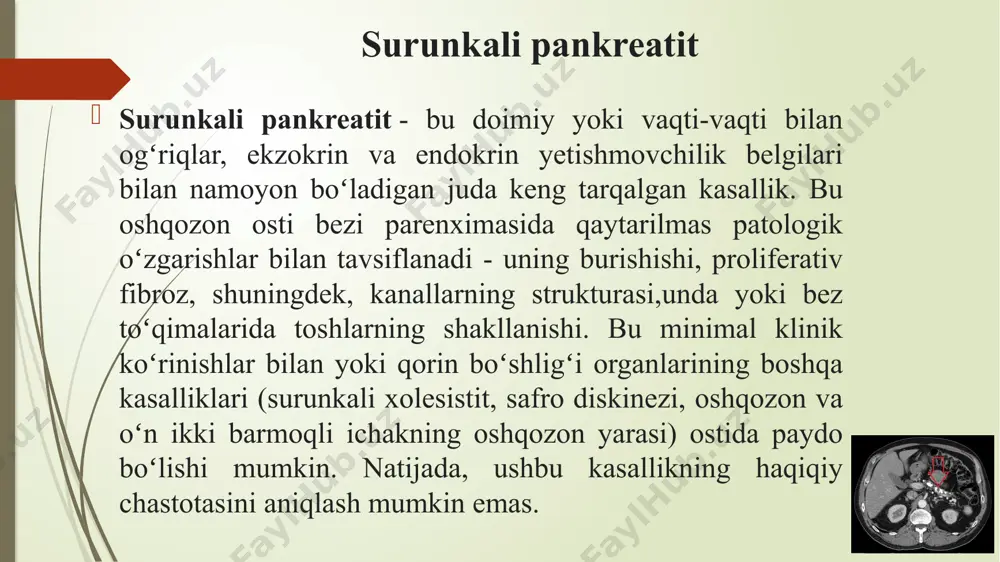 zm qiluvchi (pankreatik) shiraning me’da osti bezidan o’n ikki barmoqli ichakka quyilishining buzilishlari sanaladi. chiqish yo’llarining qisman yoki to’liq to’silib qolishi sababli shiraning bez ichida qolib ketishida, shuningdek, ichak tarkibining shira yo’llariga otilishida, fermentlar muddatidan oldin faollashadi va yaqin atrofdagi to’qimalarni hazm qila boshlaydi. oshqozon osti bezi yallig’lanishida shira va fermnetlarning ushlanib qolishi birinchi navbatda bezning to’qimalariga ta’sir o’tkazadi, ammo, uzoq muddat ta’sir etganda to’planib qolgan shira va fermentlarning salbiy ta’siri shuningdek atrofdagi to’qimalar, a’zolar va qon tomirlarga ham tarqaladi. kattalarda pankreatit rivojlanishi kattalarda kasallikning tarqalganligi bo’yicha statistik ma’lumotlar iqlim, turli mamlakatlarda qabul qilingan ovqatlanish xususiyatlari, spirtli ichimliklar ichish an’analariga bog’liq ravishda o’zgarib turadi. shuningdek, ayol va erkaklarning kasallanishi sezilarli farq qiladi, rivojlanishi mexanizmi jihatidan ham, uni keltirib chiqargan sabab bo’yicha ham. erkaklarda kasallikning rivojlanishi sabablari erkaklarda birlamchi pankreatit rivojlanishida ko’pincha spirtli ichimliklar va yog’li, yarim tayyor ovqatlarni iste’mol qilish ustunligi «trigger» bo’lib xizmat qiladi. bundan tashqari, erkaklarda kasallikning o’ziga …