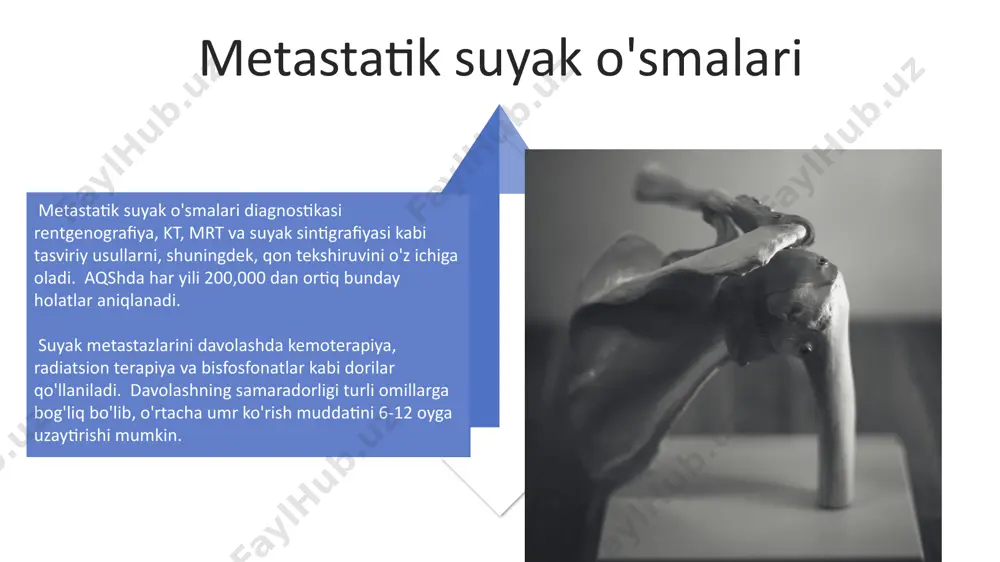 an ortiq hollari uzun suyaklarda, masalan, son va boldir suyaklarida uchraydi, bu esa amputatsiya yoki keng ko'lamli jarrohlik amaliyotlarini talab qiladi. yomon xulqli suyak o'smalari ёмон хулқли суяк ўсмаларининг 15% дан ортиғи, айниқса, 20-40 ёш оралиғидаги шахслар орасида, дунёнинг турли бурчакларида, хусусан, ақш ва европа давлатларида учрайди. остеосаркома каби ёмон хулқли суяк ўсмаларининг тарқалиш тезлиги, беморнинг ёши ва ўсманинг жойлашувига қараб, йилига 10-20% гача ўзгариши мумкин. kimyoterapiya kimyoterapiyaning yon taʼsirlari, soch toʻkilishi, koʻngil aynishi va qusish kabi noxush alomatlarni oʻz ichiga oladi. taxminan 20% bemorlarda ogʻir darajadagi yon taʼsirlar kuzatiladi, buning oldini olish uchun qoʻshimcha terapiyalar qoʻllaniladi. kimyoterapiya, suyak oʻsmalarini davolashda qoʻllaniladigan asosiy usullardan biri boʻlib, taxminan 70% hollarda, ayniqsa, metastatik kasalliklarda samarali natijalar beradi. bunday davolash tokiodagi klinikalarda keng qoʻllaniladi. ewing sarkomasi ewing sarkomasini davolashda kemoterapiya, jarrohlik va radiatsiya terapiyasi qo'llaniladi va 5 yillik omon qolish darajasi davolashning bosqichiga va joylashuviga bog'liq holda 60% dan 70% gacha. ushbu kasallikning …