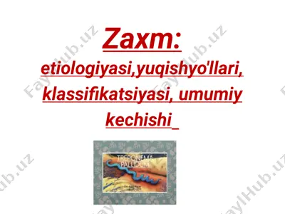 zaxm prezintatsiya — PDF