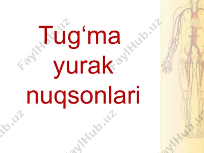 tug’ma yurak nuqsonlari — PPT
