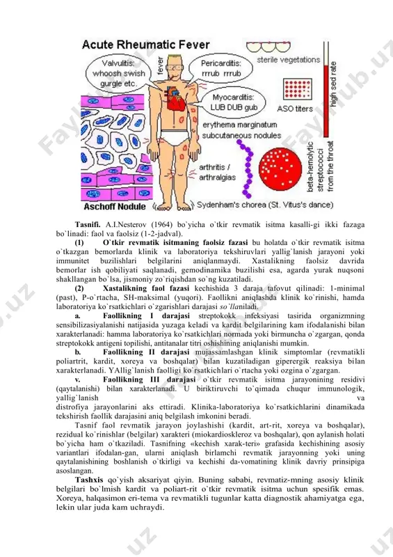 evmatik perikardit o`tkir revmatik isitmada kam kuzatiladi, asosan bolalarda va yoshlarda uchraydi. perikardit yoki ekssudativli bo`ladi. • quruq perikardit a. yurak sohasida doimiy og`riq b. to`sh suyagining chap qirg`og`ida perikardning ishqalanish shovqini eshitiladi. v. ekg - kasallik boshida 8.t oralig`i tepaga ko`tariladi, keyinchalik izoelektrik chizig`iga qaytadi. t tishchasi manfiy yoki ikki fazali. 2. ekssudativ perikardit - quruq perikarditning ri-vojlanish davomi hisoblanadi va yurak xaltachasida se-roz-fibrozli suyuqliq yig`iladi. a. yurak sohasidagi og`riq yo`qoladi. b. kuchayib boruvchi xansirash paydo bo`ladi. v. ekssudat miqdori ko`p bo`lsa yurak sohasi bo`rtib chiqadi, qovurg`a oralig`i yassilanadi, cho`zdi urishi paypaslanmaydi. g. perkussiyada yurak chegaralari har tomonga kengayadi. d. auskultasiyada yurak tovushlari va shovqinlari eshitilmaydi. e. ekg - quruq perikarditdek, qrs kompleksi voltaji pasaygan. j. utd - yurak xaltachasida ekssudat borligini tasdiqlaydi. (4) revmatikli vaskulit. o`tkir revmatik isitma ta’sirida toj arteriyalar yallig`lanishi (revmatikli koronaritlar) mayda o`choqli miokard infarktini chaqirishi mumkin. miya arteriyalarining o`tkir revmatik isitma bilan zararlanishi o`tkinchi …
