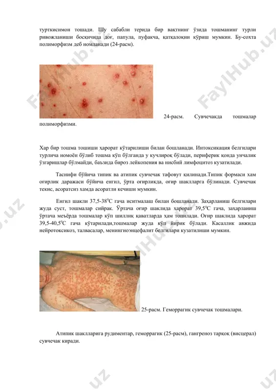 echib septik xarakterga o'tishi mumkin. kechishi. tipik hollarda suvchechak engil kechadi. harorat kasallikning 3-5 kunida normallashadi. og'ir xollarda isitmalash va toshmalar 7-10 kunga cho'ziladi, qatqaloqlar 7-14 kunda tushadi.ular o'rniga uzoq vaqtgacha engil pigmentatsiya, ba'zi xollarda yuzaki chandiqlar qoladi. asoratlari: suvchechakda asoratlar spetsifik aynan virus keltirib chiqargan va bakterial infektsiya tushishi hisobiga bo'ladi. spetsifik asoratlariga suvchechak entsefaliti, meningoentsefaliti kam xollarda mielitlar, nevritlar, miokarditlar, keratit, rey sindromi, artritlar, laringit kiradi. nospetsifik asoratlariga flegmona, streptodermiya, abtsess, impetigo, saramas, stomatit, konyuktivit, keratit kam xollarda krup va zotiljam kiradi. suvchechak entsefaliti ko'prok qatqaloqlar paydo bo'lish davrida rivojlanadi va kasallik o'tkir davri og'irligi bilan bog'liq emas. markaziy asab tizimi kasallik birinchi kunlarida toshmalar avjiga chiqqanda zararlanishi mumkin. bunda bemor ahvoli og'ir bo'lishi, gipertermiya, umumiy belgilarni tezda paydo bo'lishi xos. xushdan ketish, talvasalar kuzatiladi. ahvoli biroz yaxshilanganda o'choqli belgilar va tez o'tib ketuvchi gemiparez paydo bo'ladi. kasallikning 5-14 kunlari (rekonvalesentsiya davri) o'tkir tserebellit rivojlanishi mumkin. ahvoli yaxshilanib, …