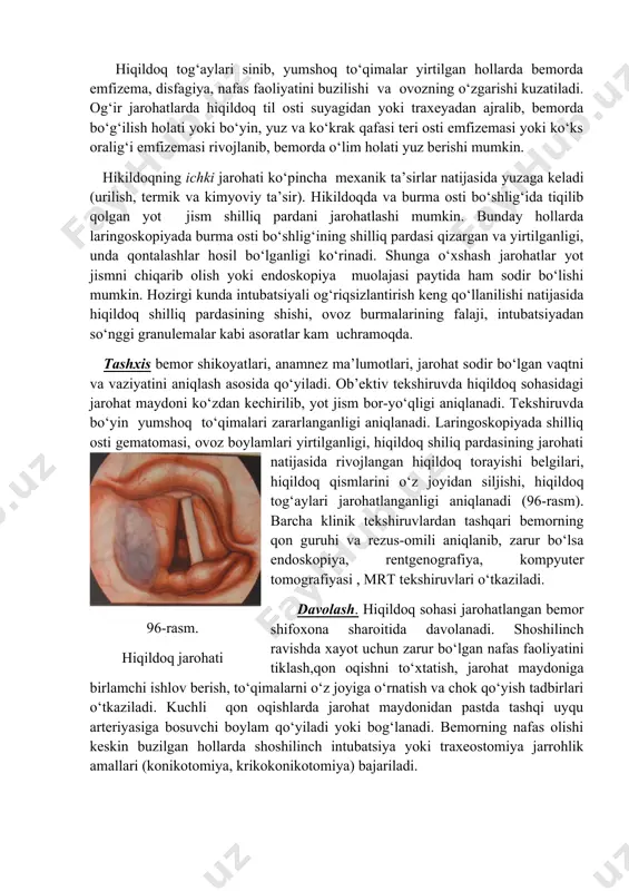 ijasida bemorda hiqildoq torayishi holati yuzaga keladi. bunday jarohatlar ko‘pincha ko‘cha-transport hodisalarida, sport o‘yinlari paytida sodir bo‘ladi. hiqildoqning yengil jaroxatlarida hiqildoq sohasida og‘riq, shish, teri ostiga qon quyilishi, ba’zan terining shilinishi kuzatiladi. til osti suyagi singan hollar quyidagi belgilar bilan kechadi: bemor og‘zini ochib, tilini chiqarganida keskin og‘riq paydo bo‘lishi, nutq va yutish harakatini qiyinligi; jarohat maydoni paypaslanganda g‘irchillash (krepitatsiya) tovushini eshitilishi. hiqildoq tog‘aylari sinib, yumshoq to‘qimalar yirtilgan hollarda bemorda emfizema, disfagiya, nafas faoliyatini buzilishi va ovozning o‘zgarishi kuzatiladi. og‘ir jarohatlarda hiqildoq til osti suyagidan yoki traxeyadan ajralib, bemorda bo‘g‘ilish holati yoki bo‘yin, yuz va ko‘krak qafasi teri osti emfizemasi yoki ko‘ks oralig‘i emfizemasi rivojlanib, bemorda o‘lim holati yuz berishi mumkin. hikildoqning ichki jarohati ko‘pincha mexanik ta’sirlar natijasida yuzaga keladi (urilish, termik va kimyoviy ta’sir). hikildoqda va burma osti bo‘shlig‘ida tiqilib qolgan yot jism shilliq pardani jarohatlashi mumkin. bunday hollarda laringoskopiyada burma osti bo‘shlig‘ining shilliq pardasi qizargan va yirtilganligi, unda …
